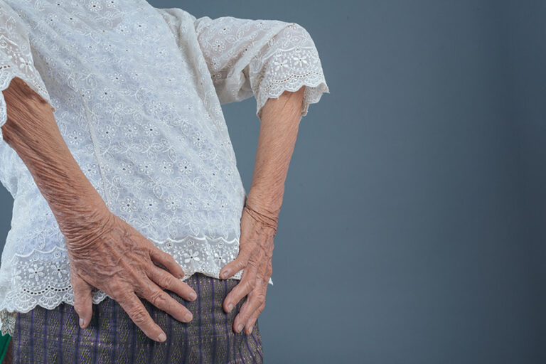 Canal lumbar estrecho: los signos sutiles que solemos pasar por alto