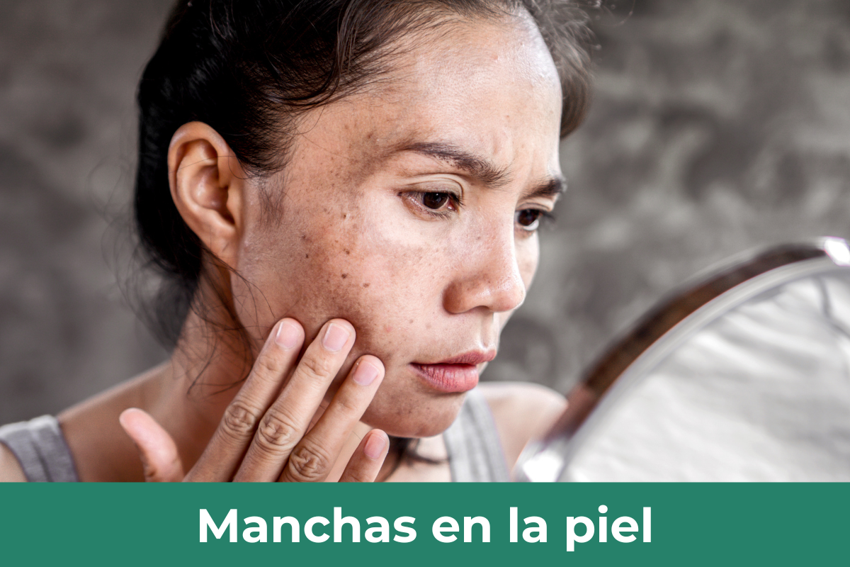 manchas de la piel